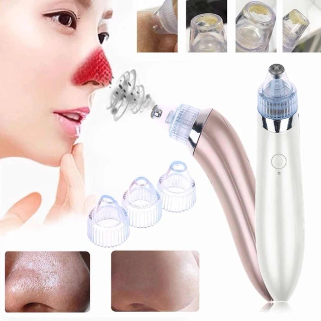 Вакуумный очиститель кожи Beauty Skin Care Specialist XN-8030 для лица 4 насадки 50 кПа аккумуляторный с индукционной зарядкой белый - изображение 3
