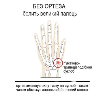 EPITACT Ортез великого пальця правої руки EP593DX3 гнучкий, день, бежевий р-р. L
