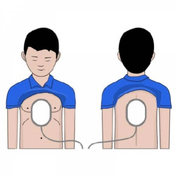 Электроды для дефибриллятора AED AMOUL для детей на липучке