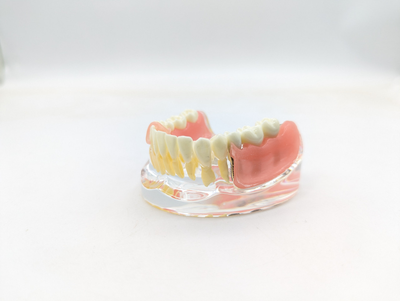 Модель стоматологічна імплантація та знімне протезування фантом