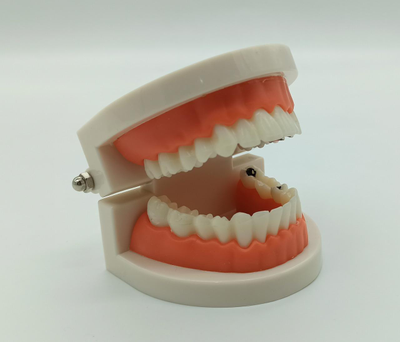 Модель стоматологическая с кариесом фантом