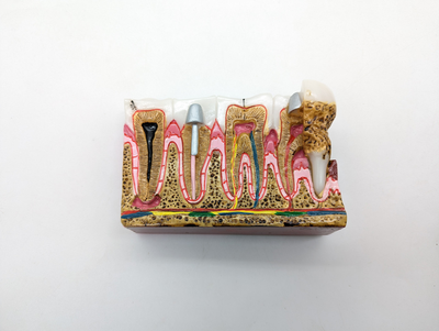 Демонстраційна модель стоматологічних захворювань