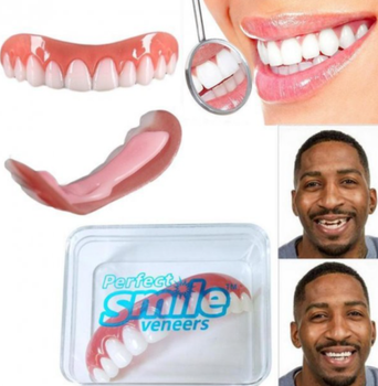 Знімні накладні вініри для зубів верхньої щелепи Perfect Smile Veneers для маскування зубів під час орто лікування