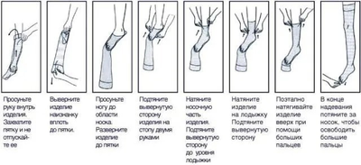 Компресійні гольфи Ortolife відкритий носок 1 клас 18-22 мм р.с. Розмір M Бежеві (OL-100)