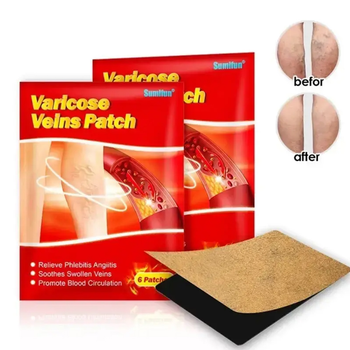 Пластырь от варикоза UKC Varicose Veins Medical Активирует кровообращение