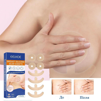 Силіконовий пластир для грудей від рубців Breast Silicone Scar Sheets