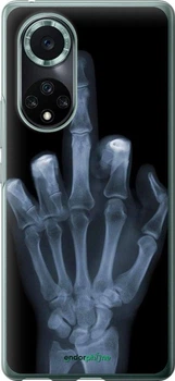 Чехол на Huawei Nova 9 Pro Рука через рентген "1007u-2503-2452827153"