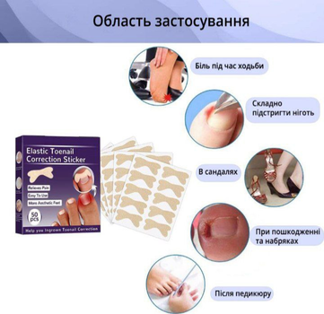 Набір пластирів Elastic Toenail Correction Sticker для корекції та усунення врослих нігтів (50 шт.)