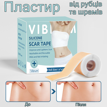 Силіконовий пластир від рубців та шрамів Silicone Scar Tape 4*150 см