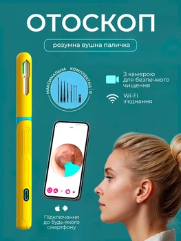 Отоскоп / розумна вушна паличка / прилад для чищення вух Natfire NK 3 Жовта