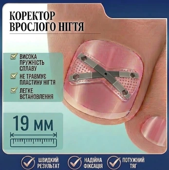 Коректор врослого нігтя X-подібний, нікелевий сплав Ingrown Toenail Correction Kit, Розмір 19 мм