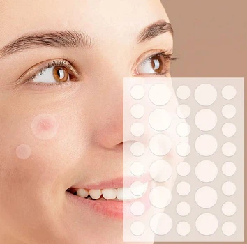 Набір пластирів від прищів та бородавок Acne Patch 72 шт