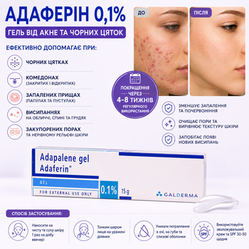 Гель Адаферин Адапален (Adaferin) Adapalene 0,1% Galderma 15 г — ретиноид от акне, комедонов и черных точек