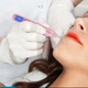 Электрокоагулятор для удаления папиллом и бородавок Plasma Pen (плазменная ручка) XPREEN 070 Розовая Б/У - изображение 2