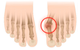 Ортопедический протектор на косточку пальцев ноги с перегородкой Foot Care GB-02 (Valgus Pro) - изображение 2