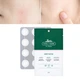 Патчи против высыпаний VT Cosmetics Cica Care Spot Patch 48шт - изображение 2