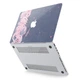 Чехол пластиковый для Apple MacBook (Розовые маки) 12 A1534 макбук - изображение 4