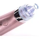 Вакуумный аппарат для чистки пор лица XN-8030 Pink (kz048) - изображение 6
