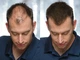 Загусник для волосся Toppik Hair Building Fibers Grey - зображення 4