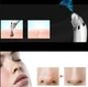 Вакуумный аппарат для чистки пор и лица Beauty Skin Care Specialist XN-8030 белый - изображение 8