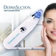 Вакуумный аппарат для чистки лица и пор UKC Derma Suction - изображение 2