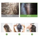 Шампунь для глубокого очищения кожи головы Masil 5 Probiotics Scalp Scaling Shampoo 8 мл 10 шт (kt-5656) - зображення 3