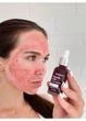 Кислотная пилинг-сыворотка для лица Hollyskin Glycolic Acid. 30 мл - изображение 3