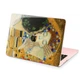 Чехол пластиковый для Apple MacBook Air 13 M2 M3 M4 M5 2022-2026 (Gustav Klimt, The Kiss) A2681/A3113/A3240/A3449 макбук эйр 13.6" аир - изображение 6