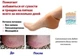Силиконовый фиксатор для пяток от мозолей и трещин Heel anti-crack sets (5652) - изображение 6