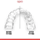 Капа OPRO Instant Custom-Fit UFC Green Silver (OICF-UFC-GrSil102529003) - зображення 4