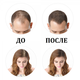 Кератиновая пудра для волос Toppik для коррекции проблемных зон (залысин) 27,5 г Блондин (Light Blonde) - изображение 4