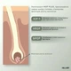 Энзимный трихологический пилинг для кожи головы Hillary Enzyme Trichological Scalp Peel, 120 мл HI-07-753 - изображение 6
