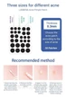 Патчи от прыщей ночные LANBENA Acne Pimple Patch Night Use (28 шт) - изображение 2