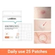 Патчи от прыщей дневные LANBENA Acne Pimple Patch Daily Use (25 шт) - изображение 3