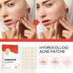 Пластир від акне та прищів Hydrocolloid Acne Patche 144 шт - зображення 5