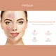 Скрабер Ультразвуковой для лица кожи Medica+ Vibroskin 5.0 (Япония) - изображение 5