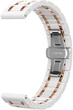 Керамический Ремешок Ceramo (20 мм) Pink White (26990-52) - изображение 2