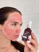 Кислотна пілінг-сироватка для обличчя Glycolic Acid Hollyskin 30 мл - изображение 8