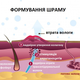 Силіконовий пластир від шрамів та рубців Epi-Derm C-Strip (3,6 х 15 см) 5 шт - зображення 4