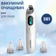 Аппарат для чистки черных точек кожи лица Sokany SK-319 Вакуумный очиститель пор 3 в 1 Белый - изображение 1