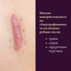 Силиконовый пластырь от шрамов и рубцов Mederma Silicone Scar Sheet Маленький (4х8 см) - изображение 9