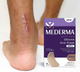 Силиконовый пластырь от шрамов и рубцов Mederma Silicone Scar Sheet Маленький (4х8 см) - изображение 10