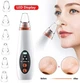 Вакуумный очиститель пор Белый Vacuum Acne Removal Tool (SH774757) - изображение 3