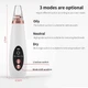 Вакуумный очиститель пор Белый Vacuum Acne Removal Tool (SH774757) - изображение 6