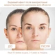 4EMS МИКРОТОК ЛИФТИНГ-МАССАЖЕР MEDICA+ SKIN LIFTING 6.0 Pink гарантия 1 год - изображение 12