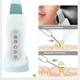 Уз скрабер для лица iCare Pure Skin ISO 1050 - изображение 2
