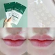 Патчи Some By Mi Clear Spot Patch 18pcs - изображение 4
