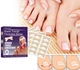 Набір пластирів для корекції врослих нігтів Elastic Toenail Correction Sticker 50 шт - изображение 1