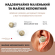 Универсальный слуховой аппарат SOUND CONTROL MEDICA+ 16 Япония - изображение 4