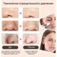 Аппарат для вакуумной глубокой чистки пор лица Multi-Functional, Вакуумный аппарат очиститель кожи и пор - изображение 5